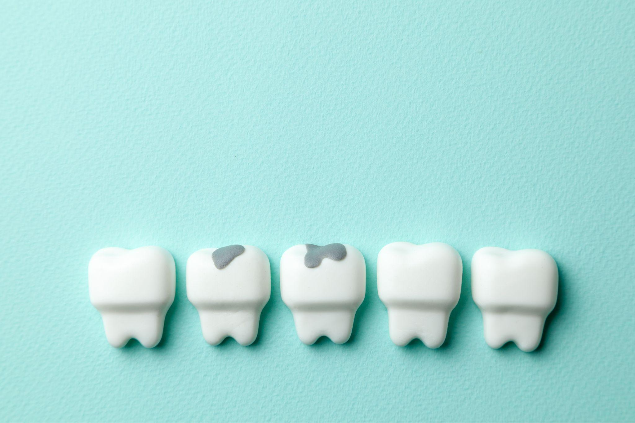 歯のクリーニングの効果