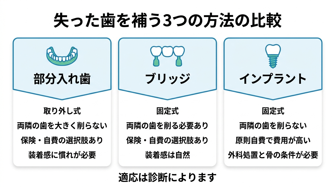 インプラント|あごの骨に人工歯根を入れる方法(原則自費)