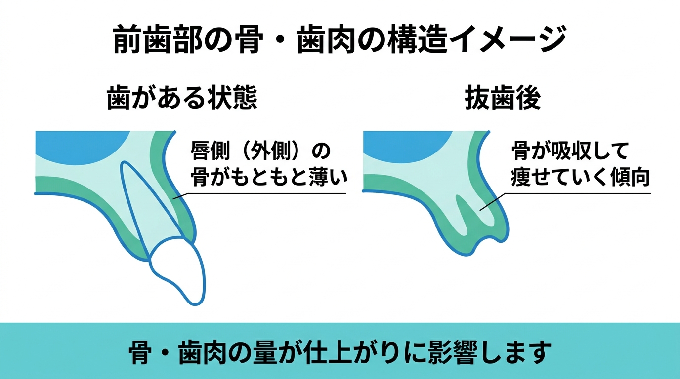 前歯部は骨・歯肉が薄く難易度が上がりやすい